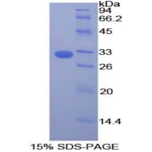 SDS-PAGE analysis of Human DOCK1 Protein.