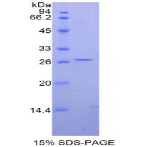 SDS-PAGE analysis of Rat GATA Binding Protein 4 Protein.