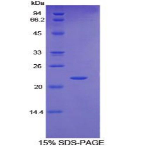 SDS-PAGE analysis of Human Glycoprotein 130 Protein.