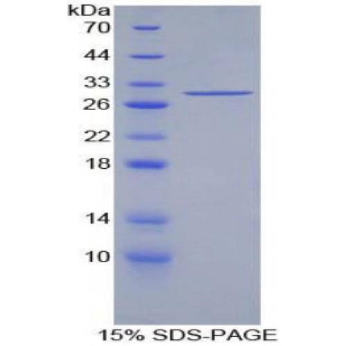 SDS-PAGE analysis of recombinant Mouse Insulin Receptor Substrate 1 (IRS1) Protein.