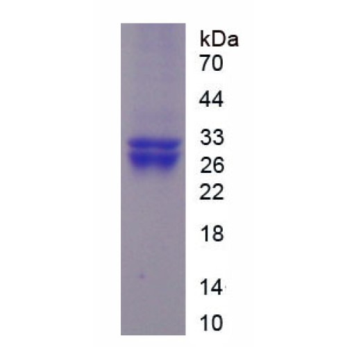 SDS-PAGE analysis of recombinant Human Protease, Serine 8 (PRSS8) Protein.