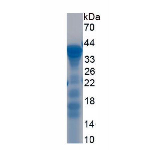 SDS-PAGE analysis of recombinant Human Topoisomerase I Protein.