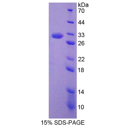 SDS-PAGE analysis of Dedicator Of Cytokinesis 2 Protein.