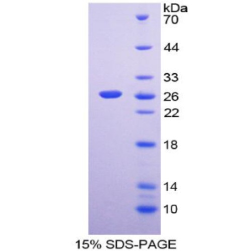 SDS-PAGE analysis of Protease, Serine 2 Protein.