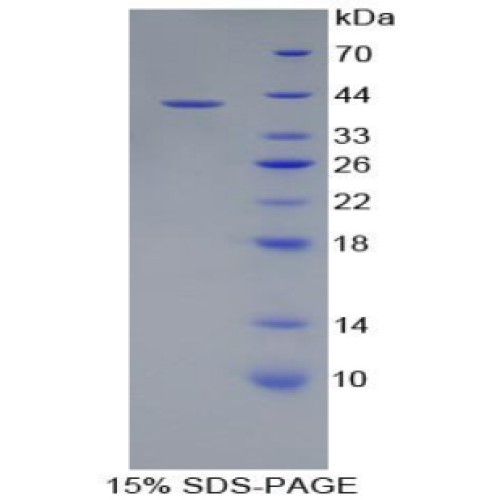 SDS-PAGE analysis of Colony Stimulating Factor 2 Receptor alpha Protein.