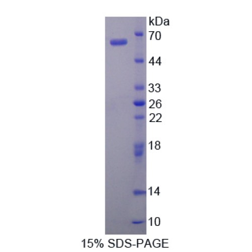 SDS-PAGE analysis of IK Cytokine, Down Regulator Of HLA II Protein.