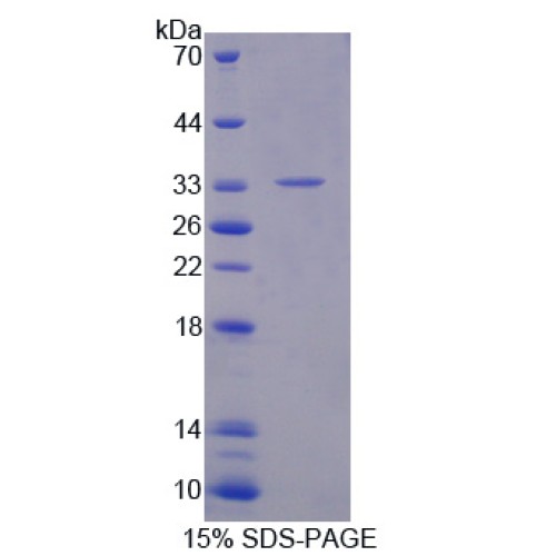 SDS-PAGE analysis of Cytokine Receptor Like Factor 1 Protein.