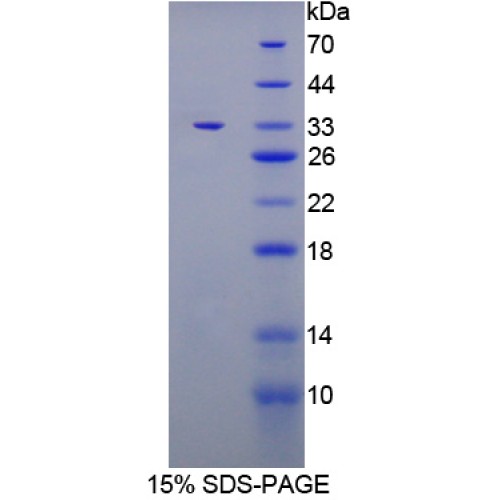 SDS-PAGE analysis of Glycoprotein 130 Protein.