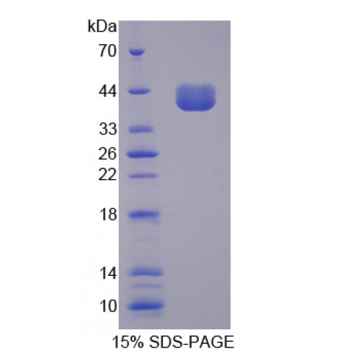 SDS-PAGE analysis of Cluster Of Differentiation 14 Protein.