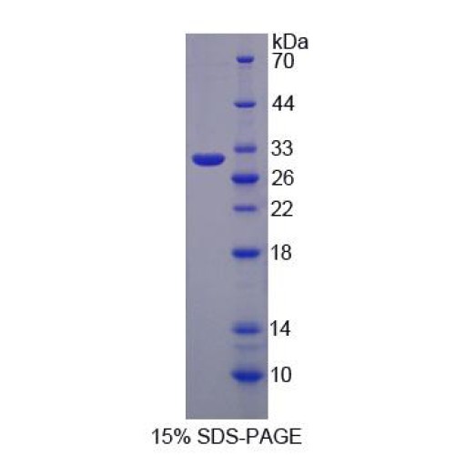 SDS-PAGE analysis of Glycoprotein A33 Protein.