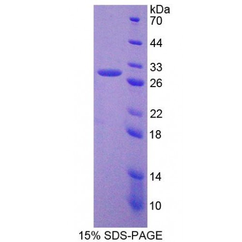 SDS-PAGE analysis of GATA Binding Protein 4 Protein.
