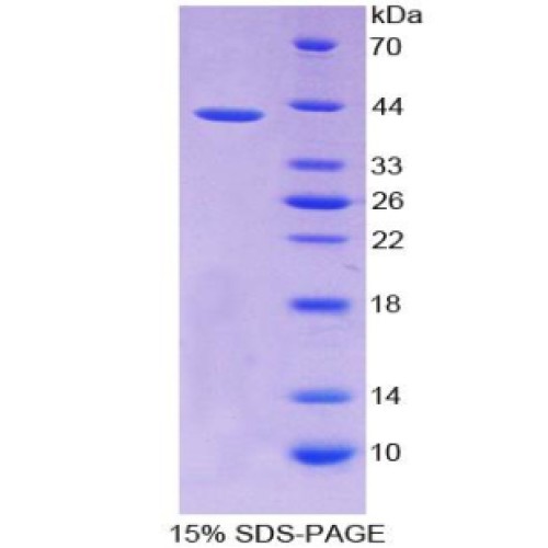 SDS-PAGE analysis of C-C Motif Chemokine Ligand 2 Protein.