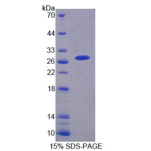 SDS-PAGE analysis of Small Ubiquitin Related Modifier Protein 1 Protein.