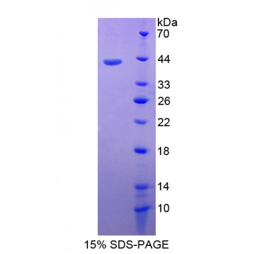 SDS-PAGE analysis of Cluster Of Differentiation 3d Protein.