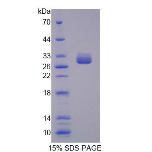 SDS-PAGE analysis of recombinant Human RNA-Binding Protein FUS Protein.