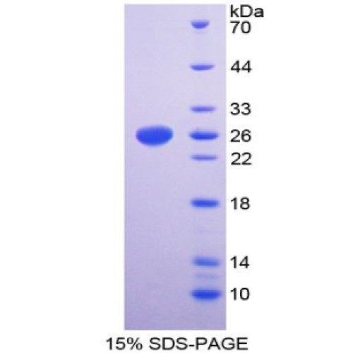 SDS-PAGE analysis of Glycoprotein V, Platelet Protein.