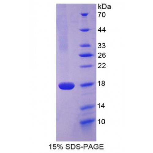 SDS-PAGE analysis of Cluster Of Differentiation 99 Protein.