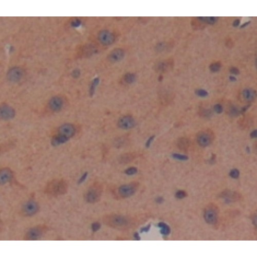 Prolactin Induced Protein (PIP) Antibody