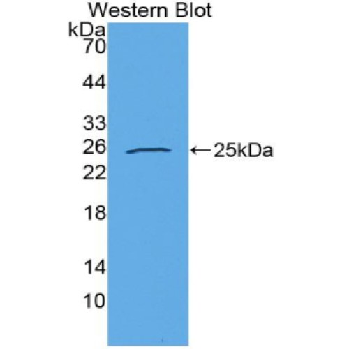 Western blot analysis of the recombinant protein.