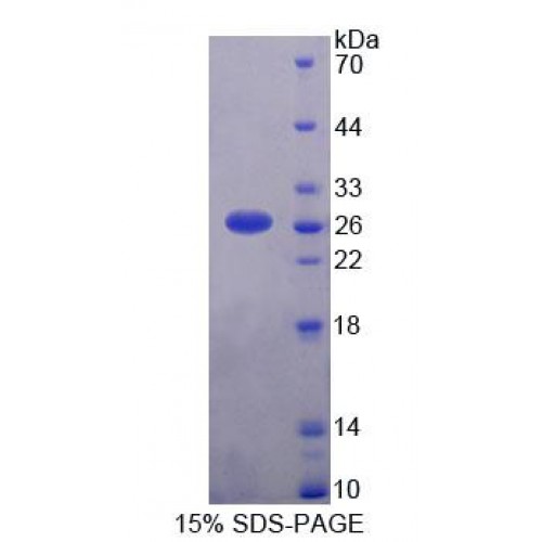 SDS-PAGE analysis of Human CHERP Protein.