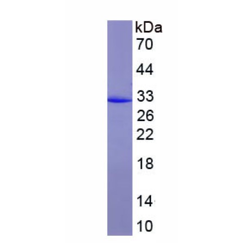 SDS-PAGE analysis of recombinant Human Insulin Receptor Substrate 1 (IRS1) Protein.
