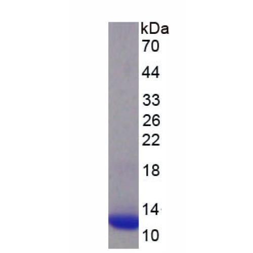 SDS-PAGE analysis of recombinant Human Synaptophysin (SYP) Protein.