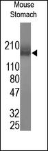 The Collagen IV (Mouse) Antibody (Cat. No. 250485) is used in Western blot to detect collagen IV in mouse stomach lysates.