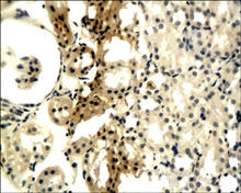 Collagen IV staining in rat kidney. Paraffin-embedded rat kidney is stained with Collagen IV (Mouse) Antibody (Cat. No. 250485) used at a 1:200 dilution.