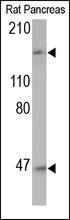 The C5a Complement Antibody (Cat. No. 250565) is used in Western blot to detect C5a in rat pancreas lysate.