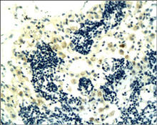 CD4 staining in rat pancreas. Paraffin-embedded rat pancreas stained with CD4 Antibody (Cat. No. 250592) used at 1:30 dilution. 