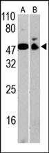 CD4 Antibody (Cat. No. 250592) is used at 1:100 dilution in Western blot to detect CD4 in mouse spleen tissue lysate (A) and Jurkat cell lysate (B).