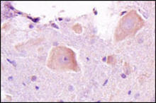 Galanin staining in rat spinal cord. Formalin-fixed paraffin-embedded rat spinal cord tissue is stained with Galanin Antibody (Cat. No. 250657) used at 1:200 dilution.