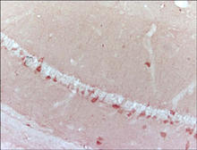 Alpha-synuclein staining in mouse brain. Frozen mouse brain tissue is stained with alpha-synuclein (n-term) antibody (Cat. No. 250917) used at 1:200 dilution.