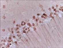 Alpha-synuclein staining in mouse brain. Frozen mouse brain is stained with Alpha-Synuclein (C-term) Antibody (Cat. No. 250918) used at 1:200 dilution.