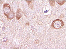 Beta-amyloid staining in rat brain. Formalin-fixed paraffin-embedded rat brain tissue is stained with Beta-Amyloid [1-42] Antibody (Cat. No. 250924) used at 1:200 dilution.