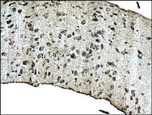 Beta-amyloid staining in mouse hippocampus. Formalin-fixed paraffin-embedded mouse hippocampus tissue is stained with Beta-Amyloid [1-42] Antibody (Cat. No. 250925) used at 1:200 dilution.