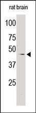 The ADRB3 Antibody (Cat. No. 251434) is used in Western blot to detect ADRB3 in rat brain tissue lysate.