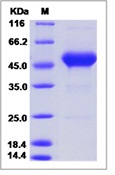 Human CD90 / THY-1 Recombinant Protein (Fc Tag)(Discontinued)