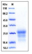 Mouse CD90 / THY-1 Recombinant Protein (His Tag)(Discontinued)