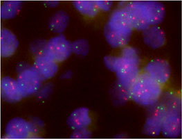 Fluorescent <i>In Situ</i> Hybridization (Formalin/PFA-fixed paraffin-embedded sections) 