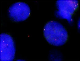 Fluorescent <i>In Situ</i> Hybridization (Formalin/PFA-fixed paraffin-embedded sections) 