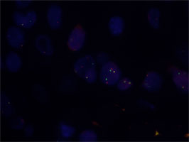 Fluorescent <i>In Situ</i> Hybridization (Formalin/PFA-fixed paraffin-embedded sections) 