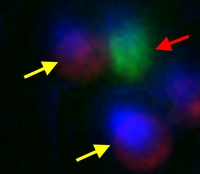 Immunofluorescence (Circulating Cancer Stem Cell)