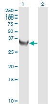 Western Blot (Transfected lysate)