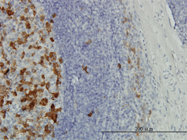 Immunohistochemistry (Formalin/PFA-fixed paraffin-embedded sections)