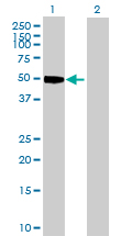 Western Blot (Transfected lysate)