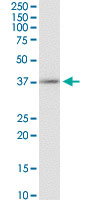 Western Blot (Cell lysate)