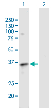 Western Blot (Transfected lysate)