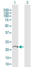 Western Blot (Transfected lysate)