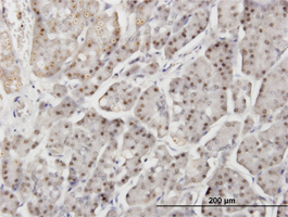 Immunohistochemistry (Formalin/PFA-fixed paraffin-embedded sections)